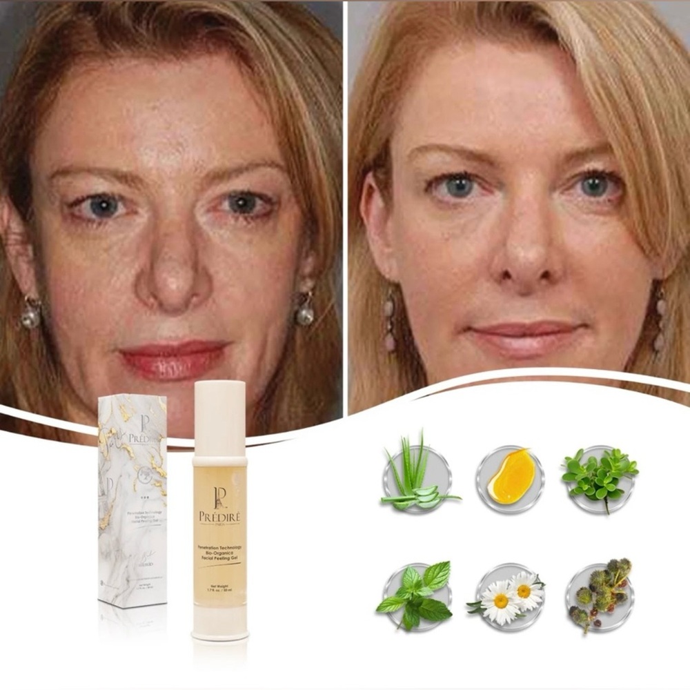 PREDIRE PARIS Bio Brightening Penetration Technology Facial Peeling Gel MSRP 300 - Picture 3 of 3
